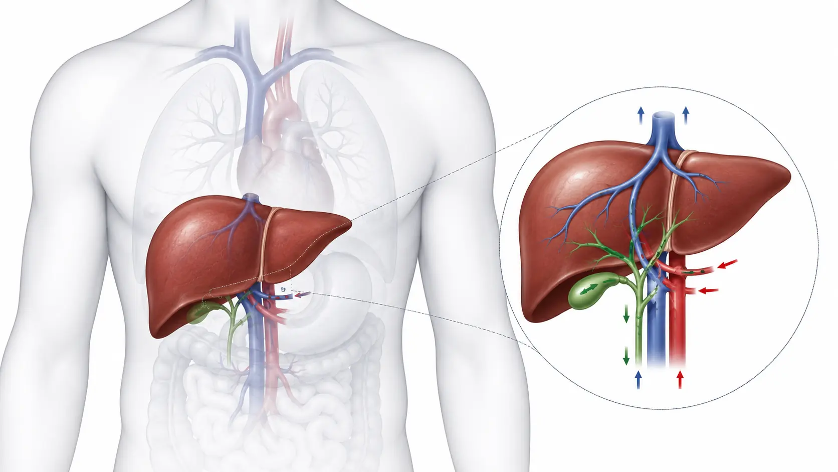 Liver transplant cost in India — diagram showing donor liver connected to blood vessels and bile duct