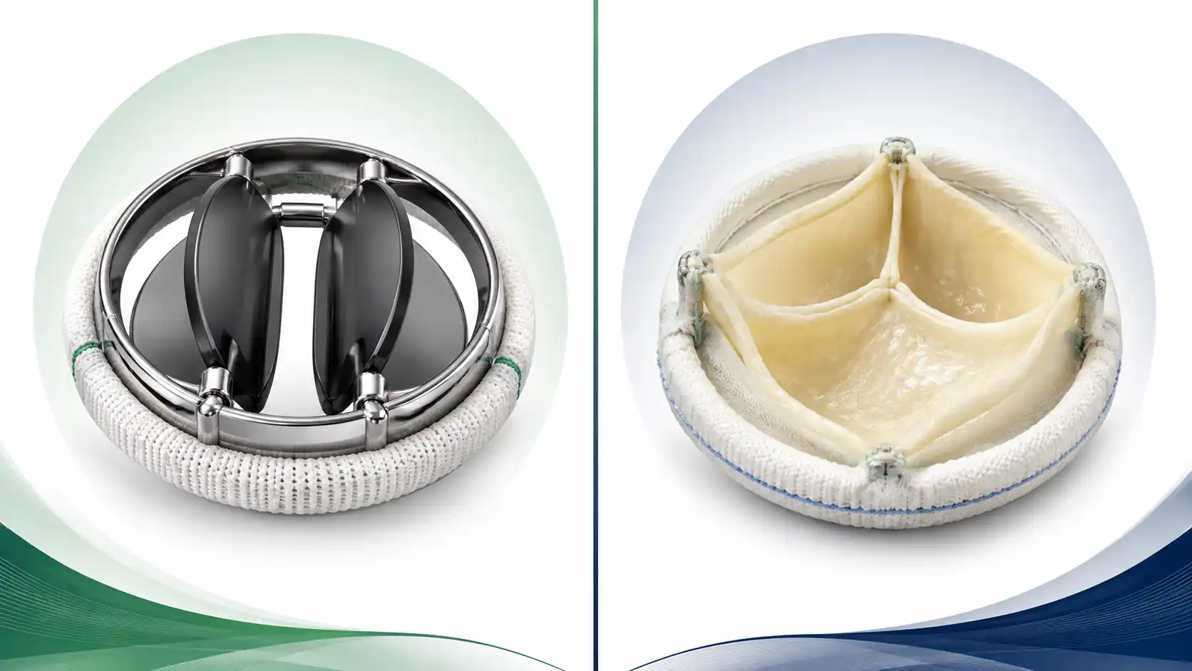 Mechanical vs biological heart valve comparison illustration