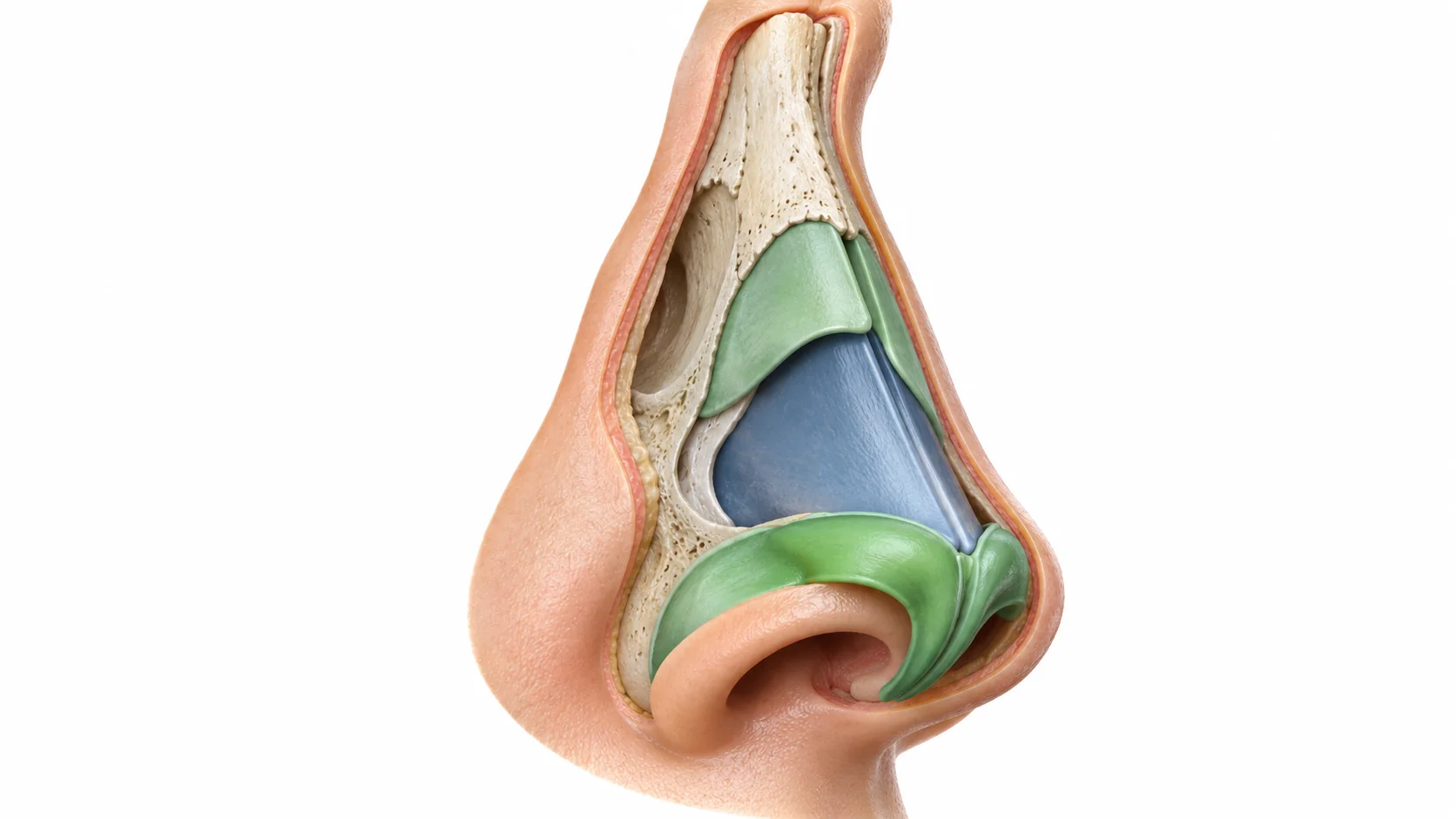 Diagram of nose anatomy showing bone, cartilage, and septum reshaped during surgery