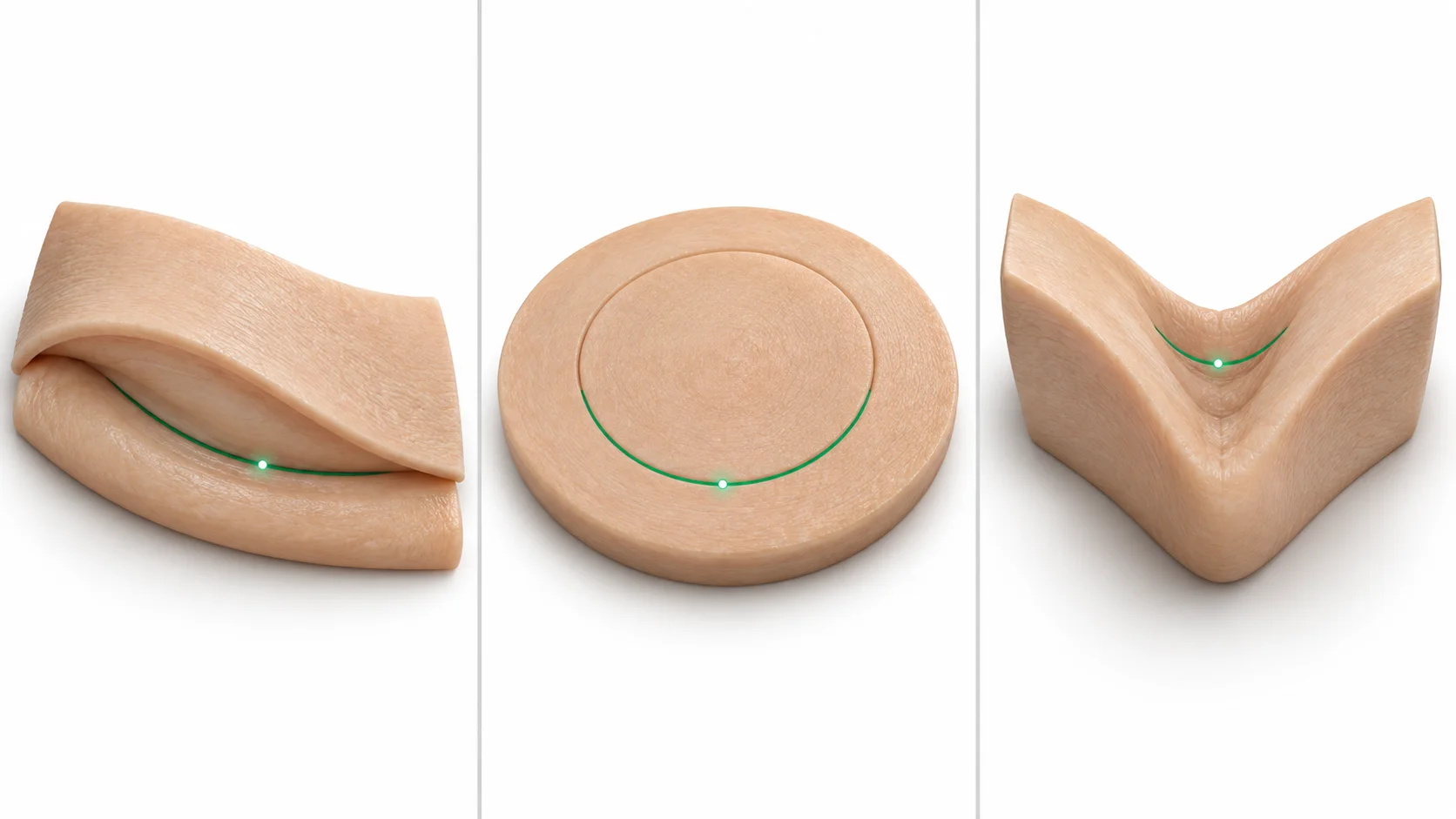 Comparison of breast implant placement and incision options for augmentation surgery